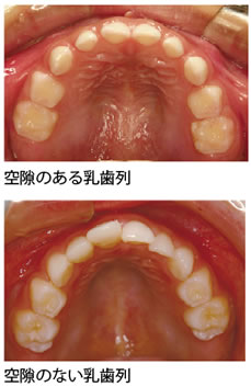 乳幼児のオーラルケア 歯並び 歯 子どもの病気 の教えて ドクター