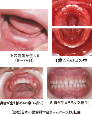 子どもの歯ならび 歯 子どもの病気 の教えて ドクター