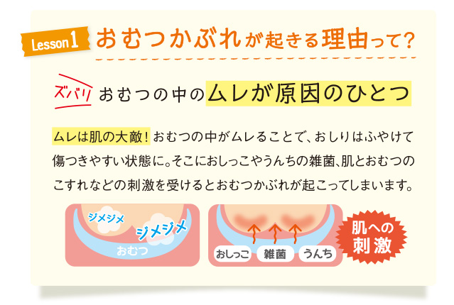 おむつかぶれが起きる理由って？