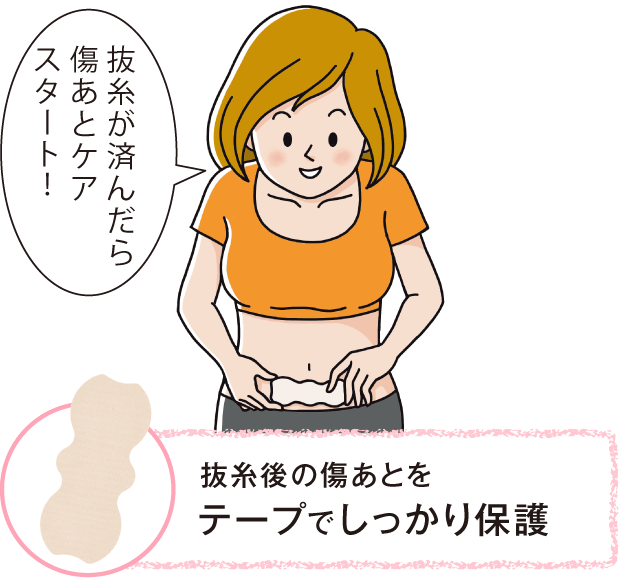 抜糸が済んだら
                傷あとケアスタート！抜糸後の傷あとをテープでしっかり保護