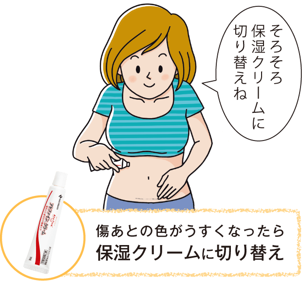 そろそろ保湿クリームに切り替えね！傷あとの色がうすくなったら保湿クリームに切り替え