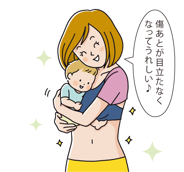 傷あとが目立たなくなってうれしい♪